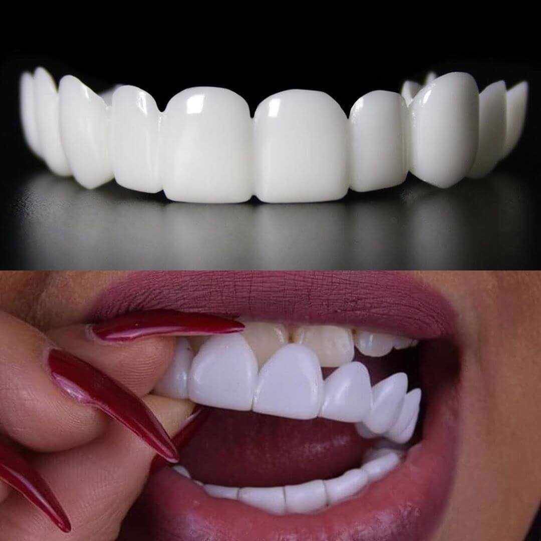 Snap-on Smile For Beautiful Smiles